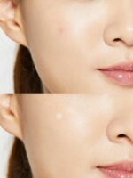 Cosrx Acne Pimple Master Patch