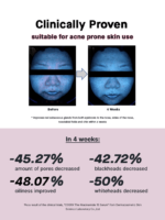 Cosrx The Niacinamide 15 [/Serum/]