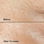 CLINIQUE Smart Clinical Repairª Wrinkle Correcting Cream